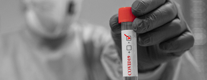 Coronavirus: tutto il mondo indaga sulle origini misteriose del Covid-19 e pretende chiarezza e trasparenza