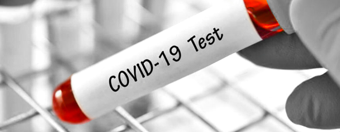 Test sierologici: tra protezione dei dati personali e responsabilità penali